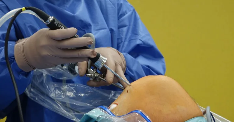 découvrez des alternatives efficaces à la réparation du genou pour soulager la douleur et améliorer la mobilité sans chirurgie invasive.